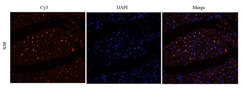 Myosin 3 antibody