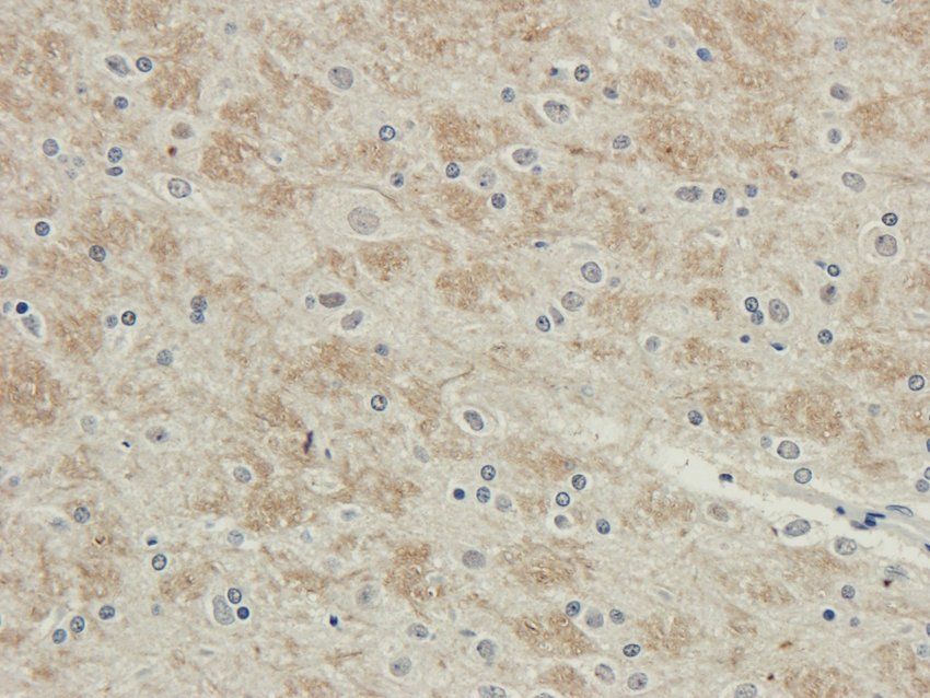 Myosin 3 antibody