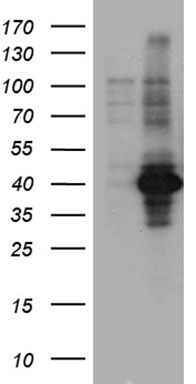 myosin light chain 1 Antibody