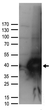myosin light chain 1 Antibody