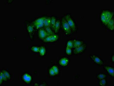 Myosin light polypeptide 6 antibody