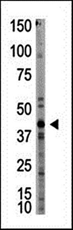 Myostatin antibody