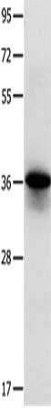 MYOZ1 Antibody