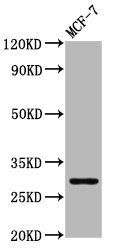 MYOZ2 antibody