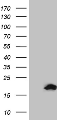 MYOZ1 Antibody
