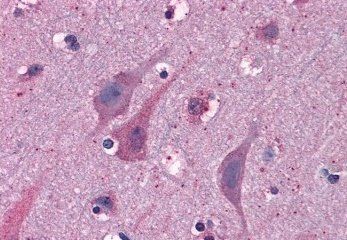 Goat anti-MYRIP / SLAC2C Antibody