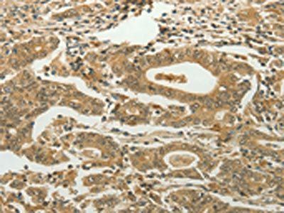 MYSM1 Antibody