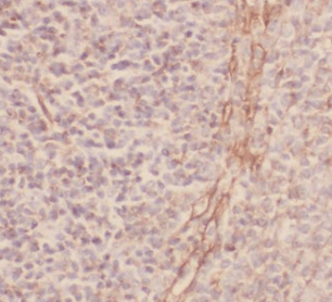 MYSM1-Specific antibody