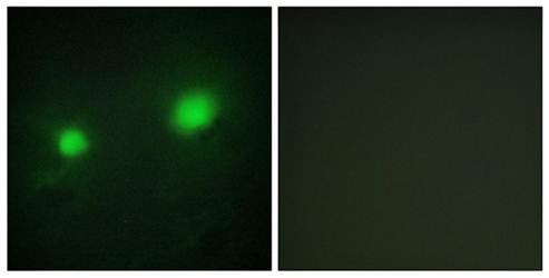 MYST2 Antibody