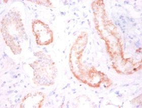 N Cadherin antibody