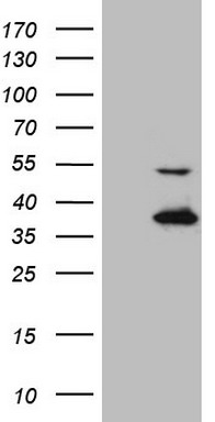 N Cadherin Antibody