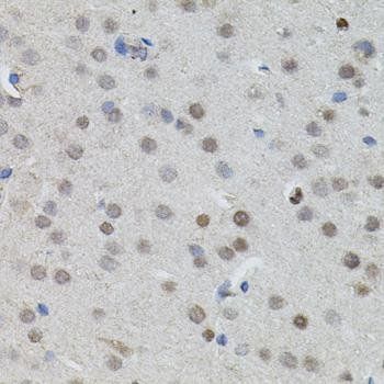 N-Myc antibody