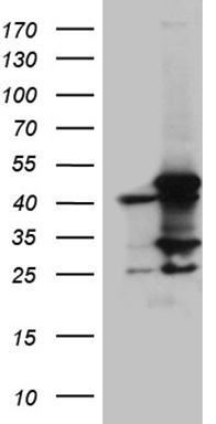 n-Myc Antibody