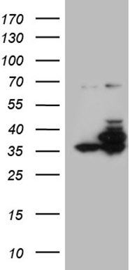 MYCN Antibody