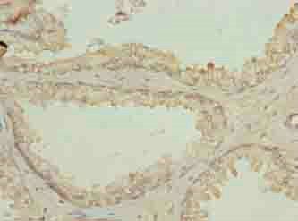 N4BP2L2 Antibody