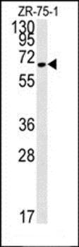 N4BP3 antibody