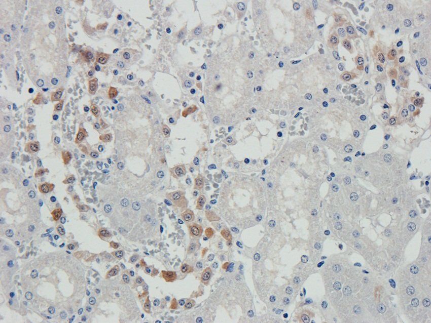 N Cadherin antibody