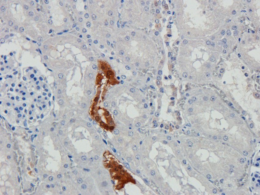 N Cadherin antibody