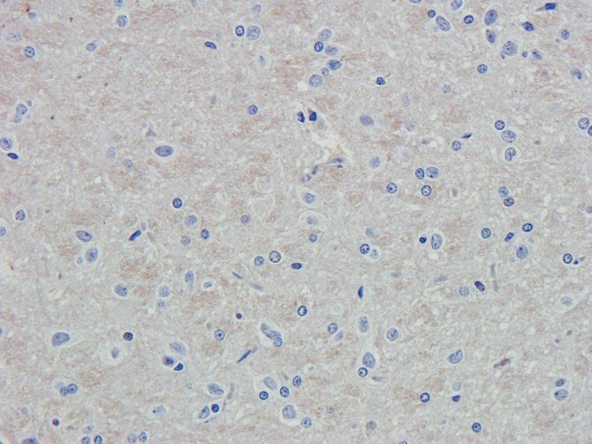 N Cadherin antibody