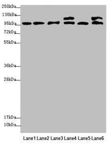 NAA25 antibody