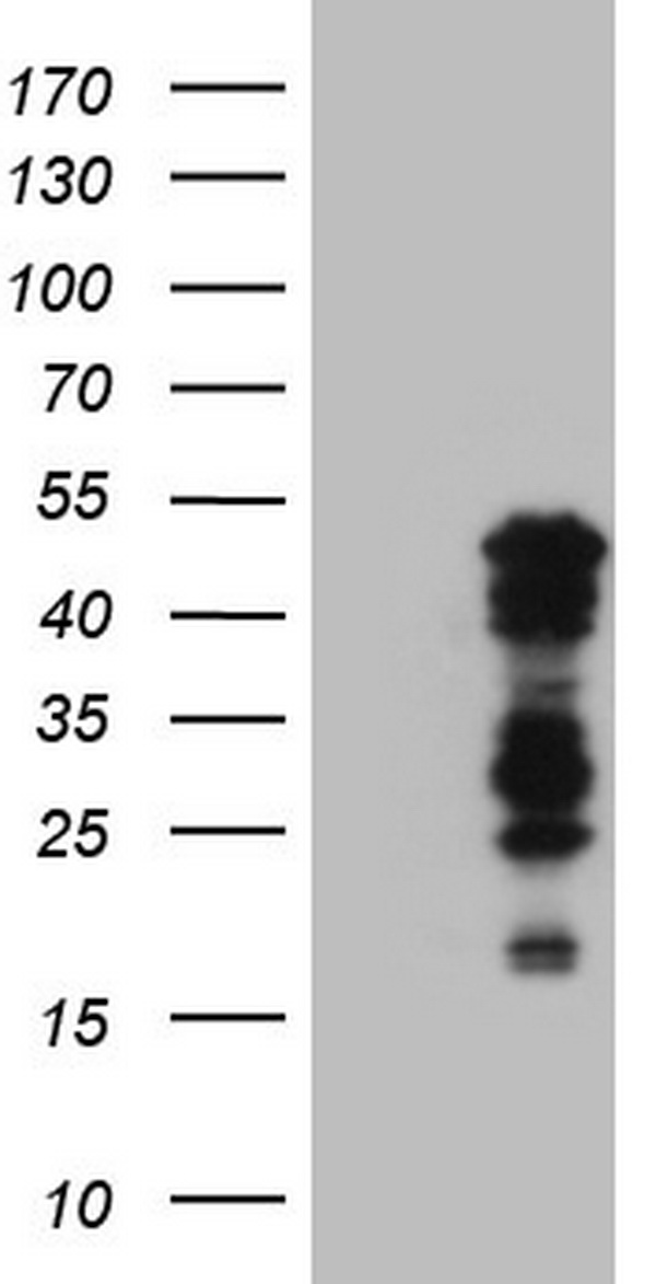 NAB1 Antibody