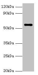 NAB2 antibody