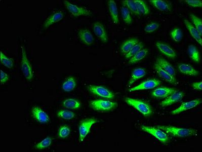 CYB5R3 Antibody