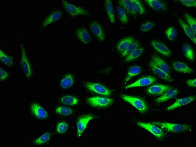 NADH-cytochrome b5 reductase 3 antibody