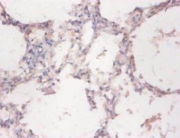 CYB5R3 Antibody