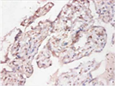CYB5R3 Antibody