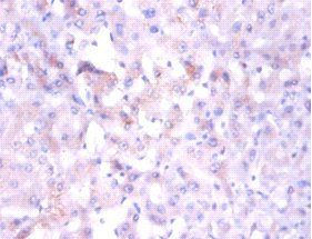 NDUFA1 Antibody