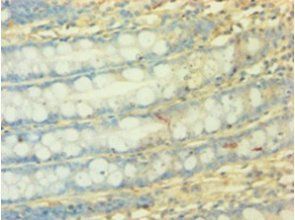 NDUFA3 Antibody