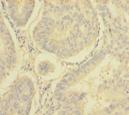 NDUFA6 Antibody
