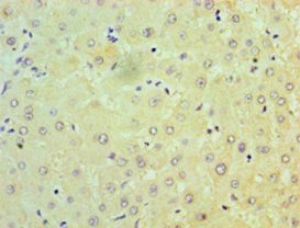NDUFB7 Antibody