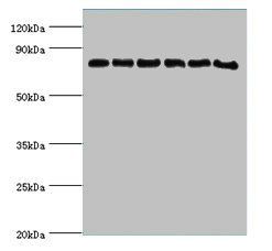 NADPH-cytochrome P450 reductase antibody