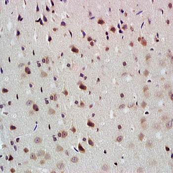 NADPH Rabbit Polyclonal Antibody