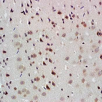 NADPH Rabbit Polyclonal Antibody