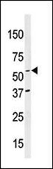 NAE1 (APPBP1) Antibody (C-term)