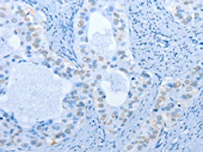 NAE1 Antibody