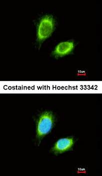 NAGAT antibody