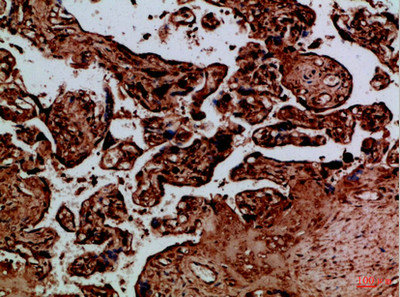 NAIP Antibody
