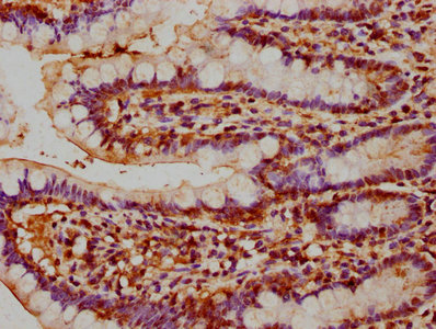 NAIP Antibody