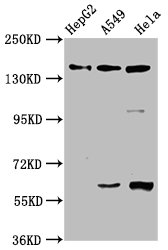 NAIP Antibody