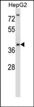 NANOS1 antibody