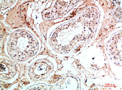 NANOS1 Antibody
