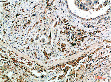 NANOS1 Antibody