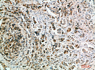 NANOS1 Antibody
