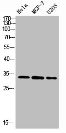 NANOS1 Antibody