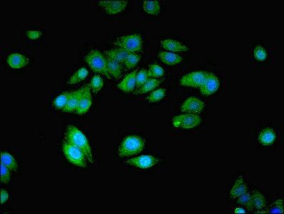 NANOS2 Antibody