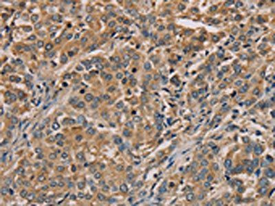 NANOS2 antibody